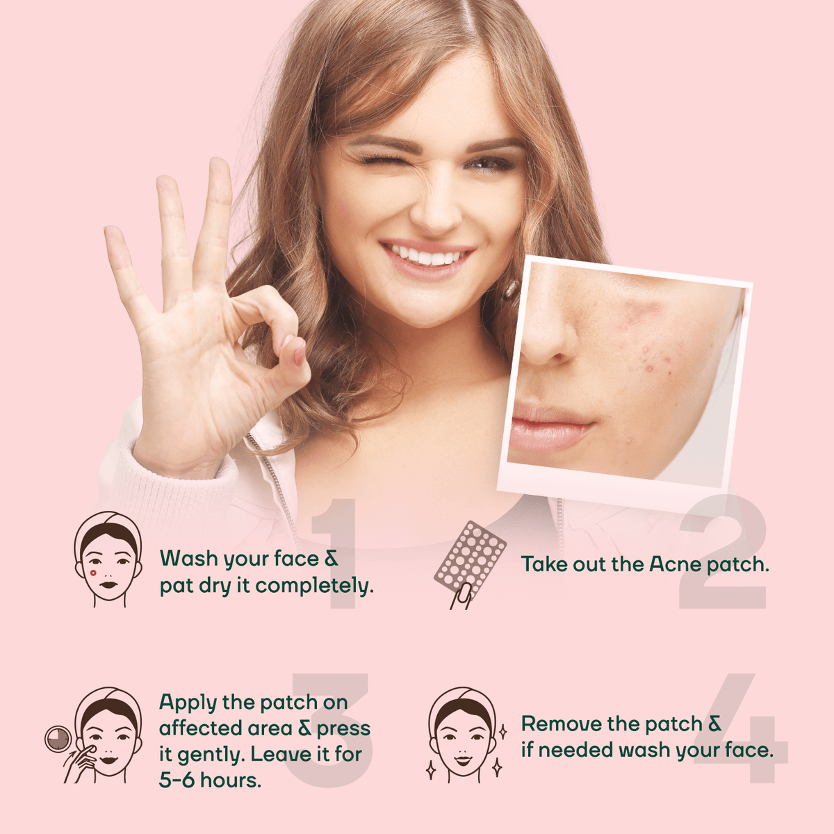 Acne Pimple Patch 72 || Acne Pimple Patch - Unisex 36 For FREE