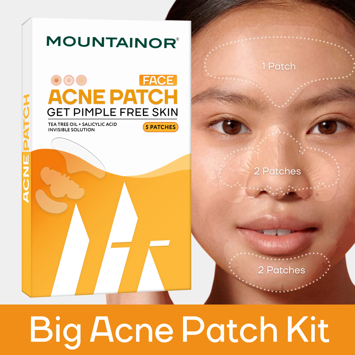 Face Acne Pimple Patch - Pack of 5