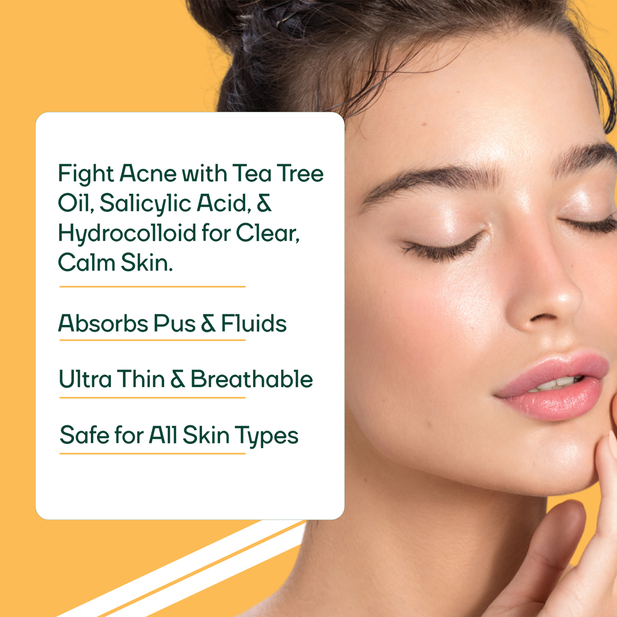 Chin Acne Patch , Salicylic Acid + Tea Tree Oil Clean & Clear Hydrocolloid-Spot Corrector